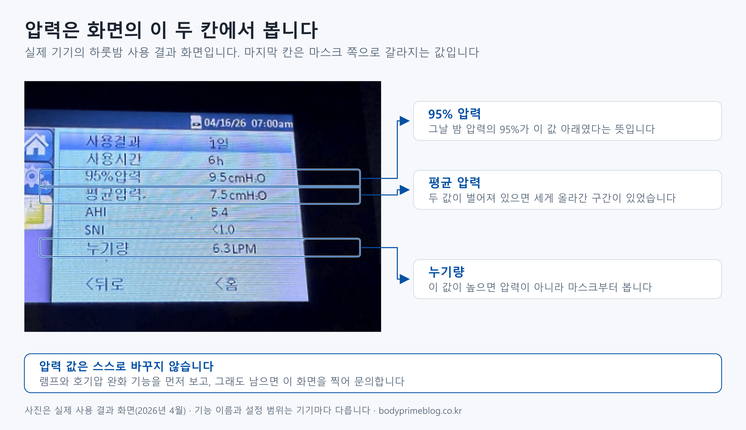 양압기 화면의 하룻밤 사용 결과 사진에 세 칸을 표시한 도식입니다. 95% 압력 9.5cmH2O는 그날 밤 압력의 95%가 그 값 아래였다는 뜻이고, 평균 압력 7.5cmH2O와 벌어져 있으면 중간에 세게 올라간 구간이 있었다는 신호입니다. 누기량 6.3LPM이 높으면 압력이 아니라 마스크부터 봅니다. 압력 값은 스스로 바꾸지 않고, 램프와 호기압 완화 기능을 먼저 본 뒤 그래도 남으면 이 화면을 찍어 문의합니다.
