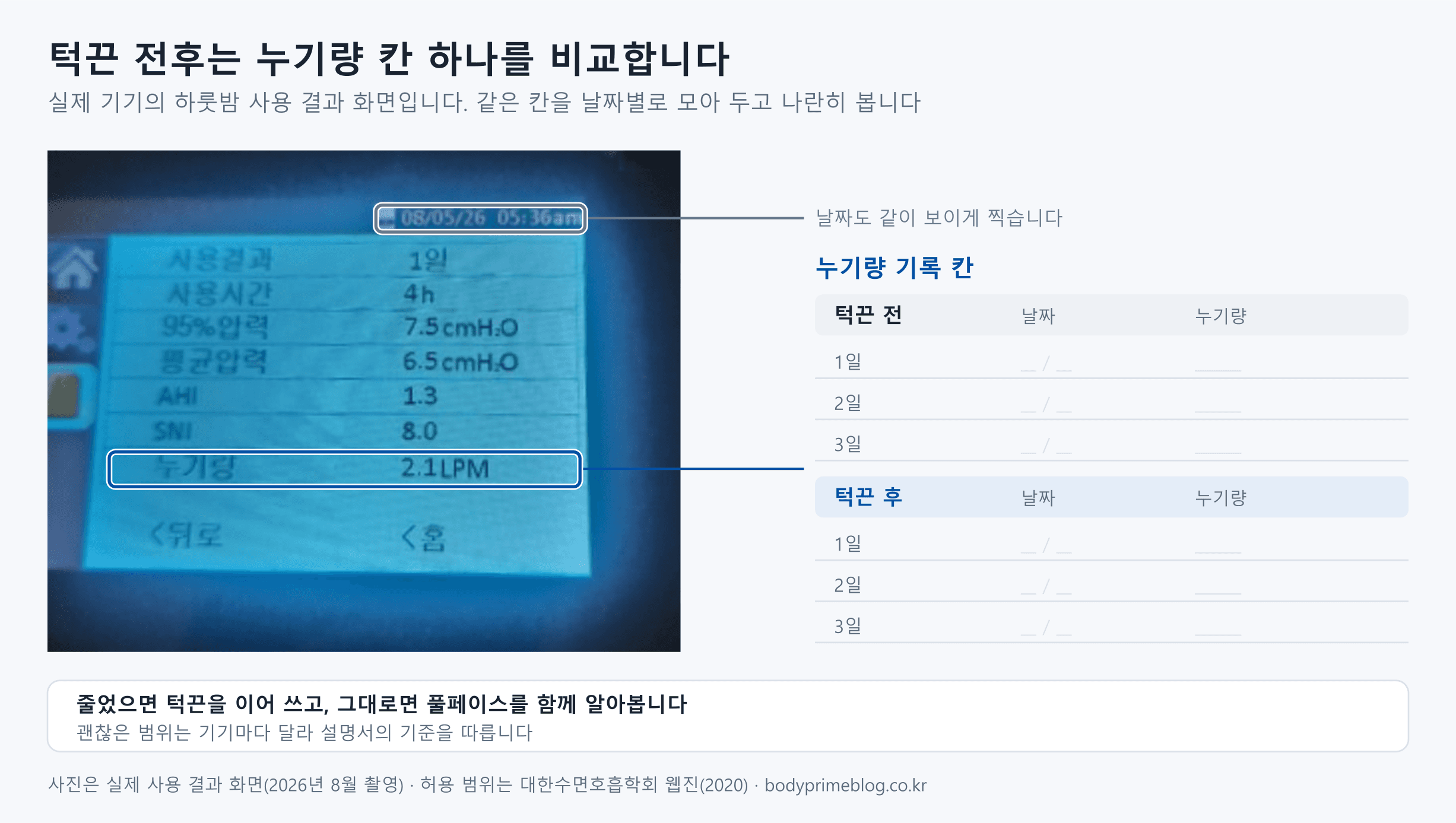 양압기 본체의 하룻밤 사용 결과 화면 사진에서 누기량 칸(2.1LPM)과 날짜 칸을 표시하고, 오른쪽에 턱끈 전 사흘과 턱끈 후 사흘의 날짜와 누기량을 적는 빈 기록 칸을 둔 도식입니다. 줄었으면 턱끈을 이어 쓰고, 그대로면 풀페이스를 함께 알아봅니다. 괜찮은 범위는 기기마다 달라 설명서의 기준을 따릅니다.