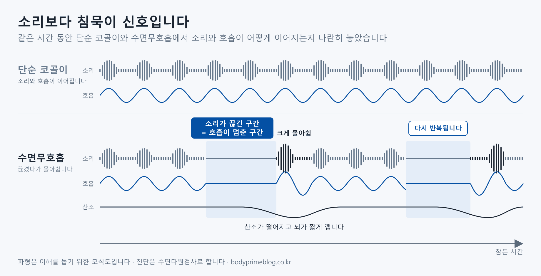 단순 코골이와 수면무호흡의 소리와 호흡을 시간축으로 비교한 모식도. 단순 코골이는 소리와 호흡이 끊기지 않고 이어진다. 수면무호흡은 코골이 소리가 뚝 끊기는 구간에 호흡도 함께 멈추고, 이후 크게 몰아쉬며, 그 뒤로 산소가 떨어졌다가 회복되는 흐름이 반복된다.