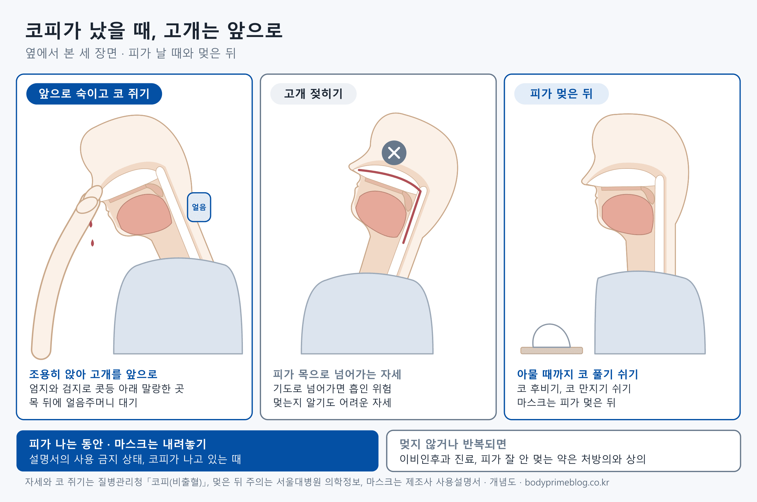 코피가 났을 때를 옆에서 본 세 장면입니다. 첫째는 조용히 앉아 고개를 앞으로 숙이고 엄지와 검지로 콧등 아래 말랑한 곳을 쥐며 목 뒤에 얼음주머니를 대는 자세입니다. 둘째는 고개를 뒤로 젖혀 피가 목으로 넘어가는 자세로, 기도로 넘어가면 흡인 위험이 있고 멎는지 알기도 어려워 피해야 한다고 표시되어 있습니다. 셋째는 피가 멎은 뒤 아물 때까지 코 풀기와 코 후비기를 쉬고 마스크는 피가 멎은 뒤에 쓰는 장면입니다. 아래에는 피가 나는 동안은 설명서상 사용 금지 상태라 마스크를 내려놓고, 멎지 않거나 반복되면 이비인후과 진료를 받으며 피가 잘 안 멎는 약은 처방한 의사와 상의하라고 적혀 있습니다.