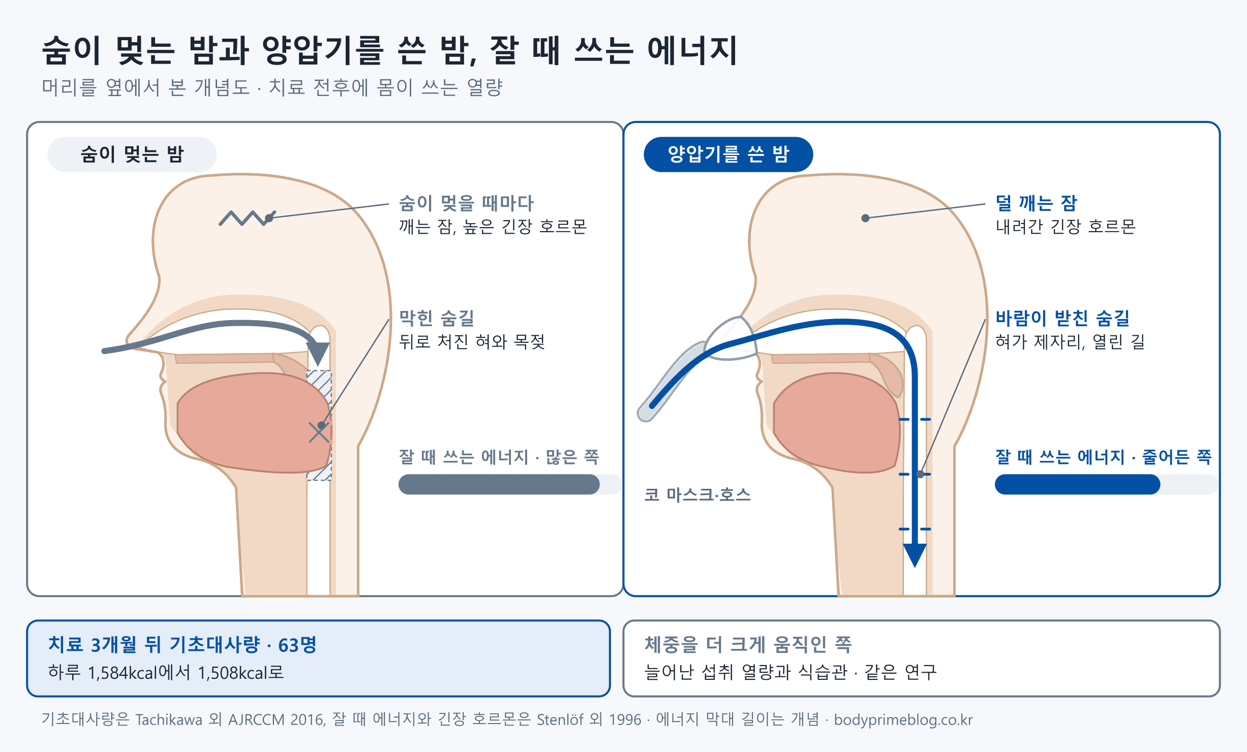 머리를 옆에서 본 개념도 두 장입니다. 숨이 멎는 밤에는 뒤로 처진 혀와 목젖이 숨길을 막고, 숨이 멎을 때마다 잠이 깨며 긴장 호르몬이 높아 잘 때 쓰는 에너지가 많습니다. 양압기를 쓴 밤에는 코 마스크와 호스로 들어온 바람이 숨길을 받쳐 혀가 제자리에 있고, 덜 깨며 긴장 호르몬이 내려가 잘 때 쓰는 에너지가 줄어듭니다. 아래에는 63명을 본 연구에서 치료 3개월 뒤 기초대사량이 하루 1,584kcal에서 1,508kcal로 줄었고, 체중을 더 크게 움직인 것은 늘어난 섭취 열량과 식습관이었다고 적혀 있습니다. 에너지 막대 길이는 개념입니다.