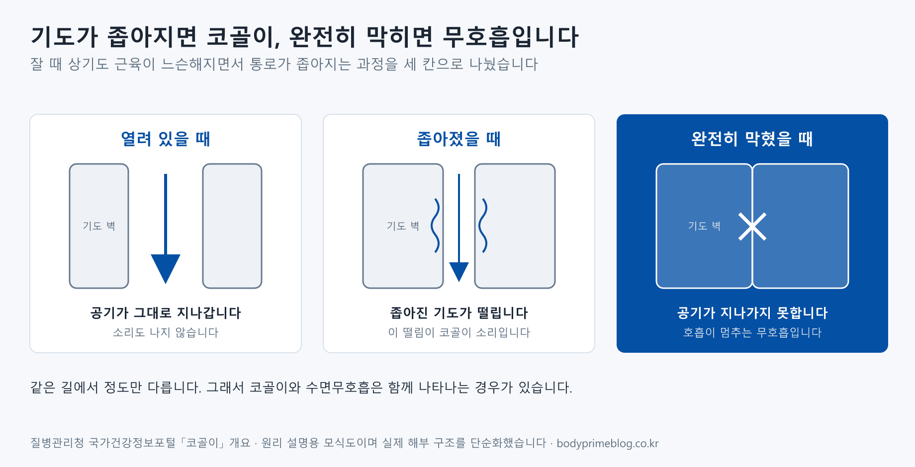 기도가 열린 정도를 세 칸으로 나눈 모식도입니다. 열려 있을 때는 공기가 그대로 지나가고 소리도 나지 않습니다. 좁아졌을 때는 좁아진 기도가 떨리고 그 떨림이 코골이 소리가 됩니다. 완전히 막혔을 때는 공기가 지나가지 못해 호흡이 멈추는 무호흡이 됩니다.