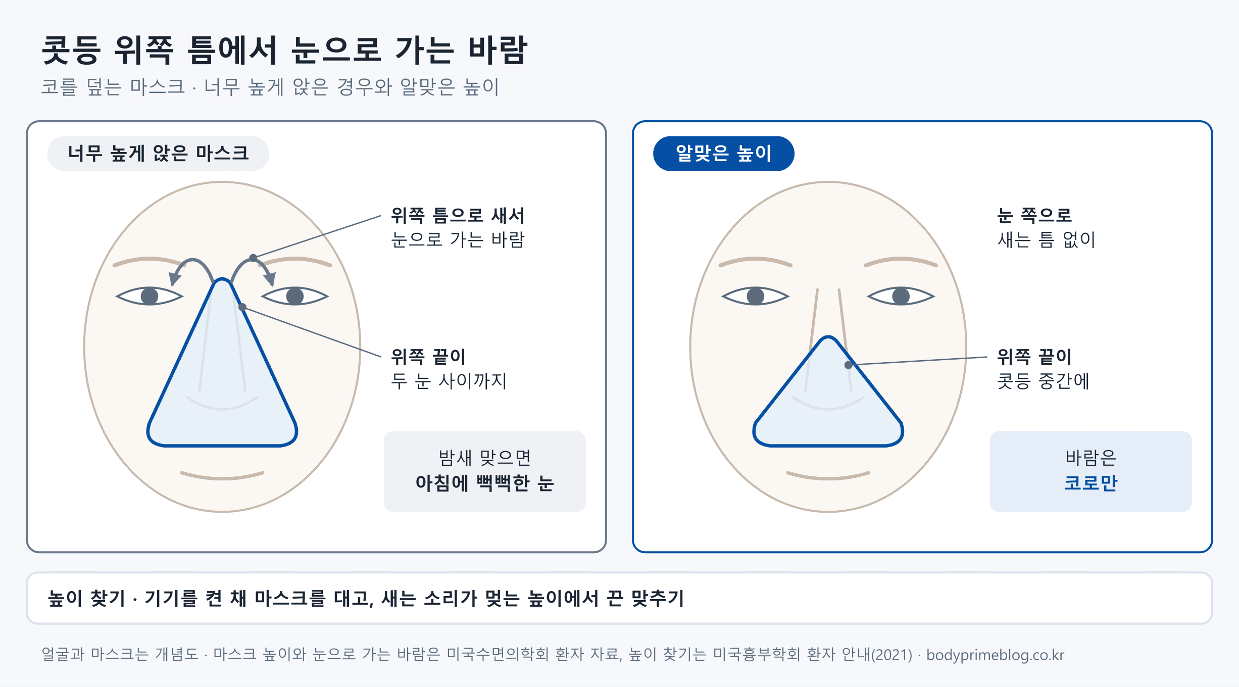 코를 덮는 양압기 마스크를 정면에서 그린 개념도입니다. 왼쪽은 마스크 위쪽 끝이 두 눈 사이까지 올라가 너무 높게 앉은 경우로, 위쪽 틈으로 새는 바람이 양쪽 눈으로 향하고 밤새 맞으면 아침에 눈이 뻑뻑해집니다. 오른쪽은 위쪽 끝이 콧등 중간에 붙은 알맞은 높이로, 눈 쪽으로 새는 틈 없이 바람이 코로만 갑니다. 아래에는 기기를 켠 채 마스크를 대고 새는 소리가 멎는 높이에서 끈을 맞추라고 적혀 있습니다.