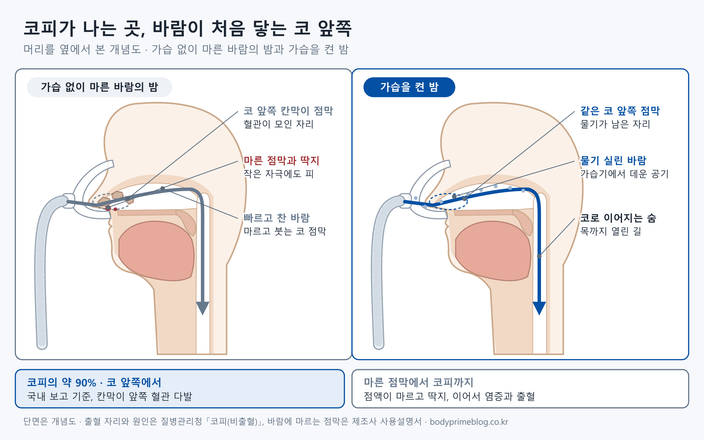 머리를 옆에서 자른 개념도 두 장면입니다. 왼쪽은 가습 없이 마른 바람이 코만 덮는 마스크를 지나 코 앞쪽 칸막이 점막에 먼저 닿고, 그 자리에 마른 딱지와 피가 생긴 밤입니다. 오른쪽은 가습을 켜 물기 실린 바람이 같은 자리를 지나 목까지 가는 밤입니다. 아래에는 코피의 약 90%가 코 앞쪽에서 난다는 국내 보고와, 점액이 마르고 딱지가 생긴 뒤 염증과 출혈로 이어진다는 질병관리청 설명이 적혀 있습니다.