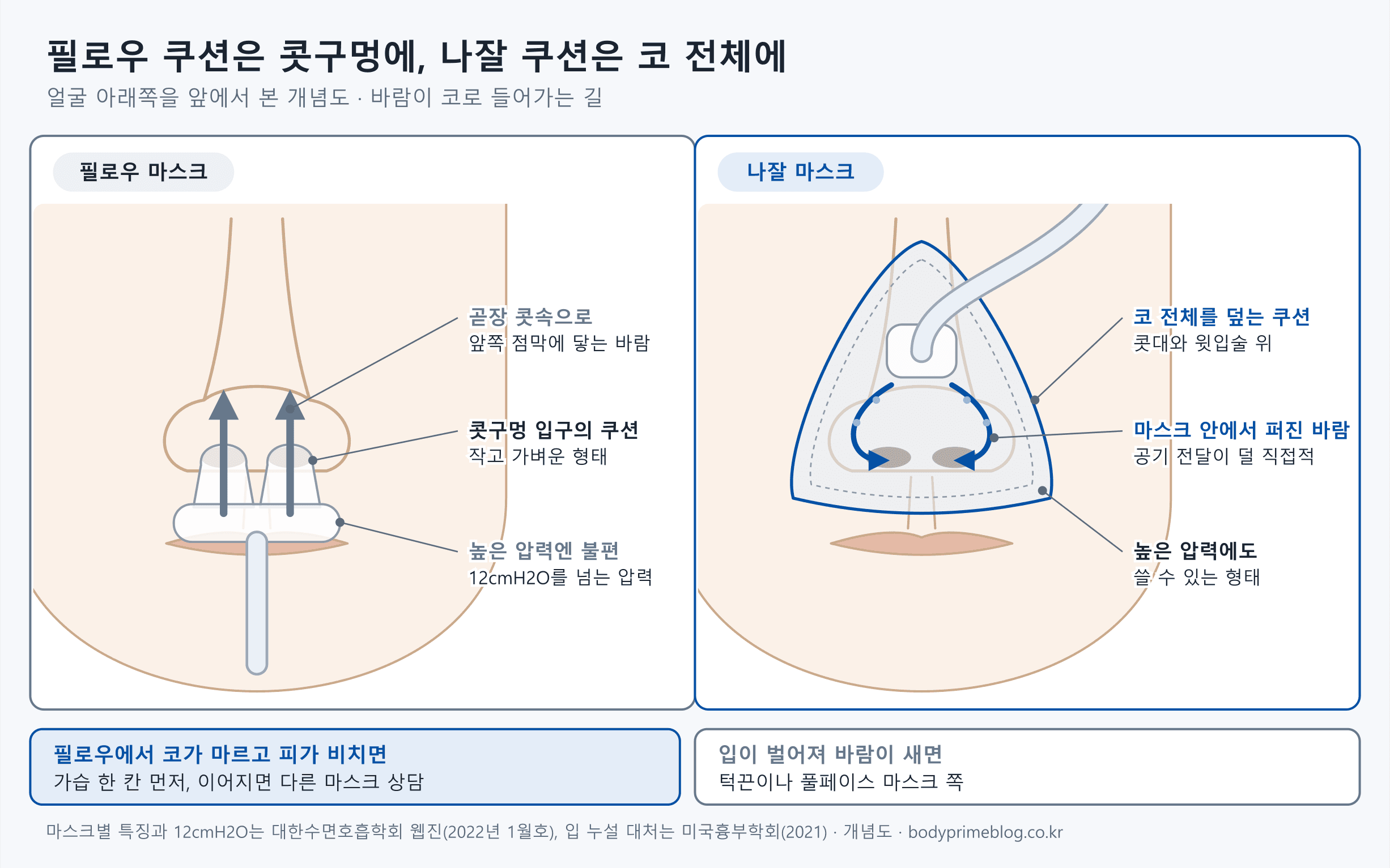 얼굴 아래쪽을 앞에서 본 개념도 두 장면입니다. 왼쪽 필로우 마스크는 쿠션 두 개가 콧구멍 입구에 바로 닿아 바람이 콧속 앞쪽 점막으로 곧장 들어가고, 12cmH2O를 넘는 높은 압력에서는 불편하다는 설명이 붙어 있습니다. 오른쪽 나잘 마스크는 코 전체를 덮는 쿠션 안에서 바람이 퍼진 뒤 콧구멍으로 들어가 공기 전달이 덜 직접적이고 높은 압력에도 쓸 수 있다고 적혀 있습니다. 아래에는 필로우에서 코가 마르고 피가 비치면 가습을 먼저 올리고 이어지면 다른 마스크를 상담하라는 내용과, 입이 벌어져 새면 턱끈이나 풀페이스 마스크 쪽이라는 내용이 있습니다.