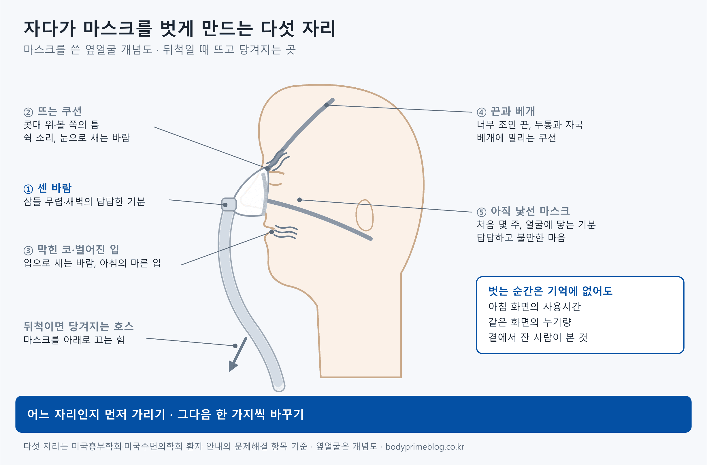 나잘 마스크를 쓴 옆얼굴 개념도에 다섯 자리를 표시했습니다. ①은 잠들 무렵이나 새벽에 답답하게 느껴지는 센 바람으로 마스크 이음관을 가리킵니다. ②는 콧대 위나 볼 쪽에서 뜨는 쿠션으로, 쉭 소리와 눈으로 새는 바람이 납니다. ③은 막힌 코와 벌어진 입으로, 입으로 바람이 새고 아침에 입이 마릅니다. ④는 끈과 베개로, 너무 조인 끈은 두통과 자국을 부르고 베개가 쿠션을 밉니다. ⑤는 처음 몇 주 아직 낯선 마스크로, 답답하고 불안한 기분입니다. 뒤척이면 호스가 마스크를 아래로 당깁니다. 오른쪽 상자에는 벗는 순간은 기억에 없어도 아침 화면의 사용시간, 같은 화면의 누기량, 곁에서 잔 사람이 본 것이 남는다고 적혀 있고, 아래 띠에는 어느 자리인지 먼저 가린 뒤 한 가지씩 바꾸라고 적혀 있습니다.