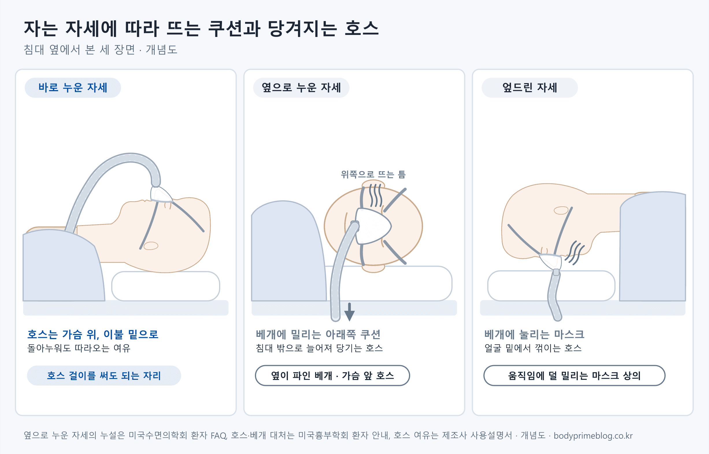 침대 옆에서 본 세 장면의 개념도입니다. 바로 누운 자세에서는 호스가 마스크에서 위로 나와 가슴 위 이불 밑으로 들어가 돌아누워도 따라오는 여유가 있고, 호스 걸이를 써도 되는 자리로 표시되어 있습니다. 옆으로 누운 자세에서는 베개가 아래쪽 쿠션을 밀어 위쪽으로 틈이 뜨고 바람이 새며, 침대 밖으로 늘어진 호스가 마스크를 당깁니다. 대처로 옆이 파인 베개와 가슴 앞 호스가 적혀 있습니다. 엎드린 자세에서는 마스크가 베개에 눌리고 호스가 얼굴 밑에서 꺾이며, 움직임에 덜 밀리는 마스크를 상의하라고 적혀 있습니다.