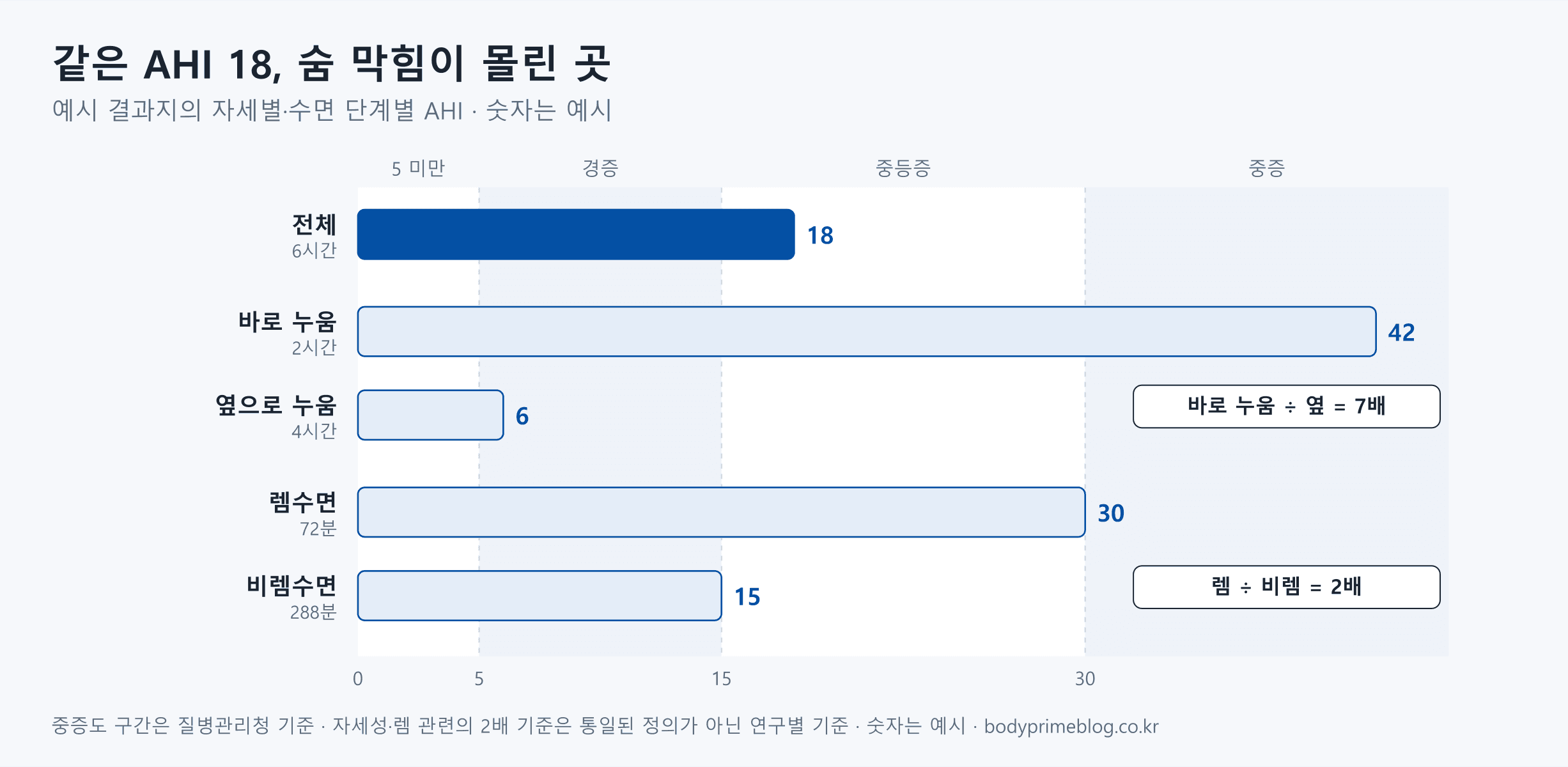 예시 결과지의 자세별·수면 단계별 AHI를 가로 막대로 비교한 그래프입니다. 전체 AHI는 18이지만 바로 누운 2시간은 42, 옆으로 누운 4시간은 6으로 바로 누웠을 때가 7배였습니다. 렘수면 72분은 30, 비렘수면 288분은 15로 렘수면이 2배였습니다. 배경에는 질병관리청 중증도 구간인 5~15 미만 경증, 15~30 미만 중등증, 30 이상 중증을 표시했습니다. 자세성과 렘 관련 수면무호흡을 2배로 보는 기준은 연구마다 다르고 통일된 정의는 없습니다.