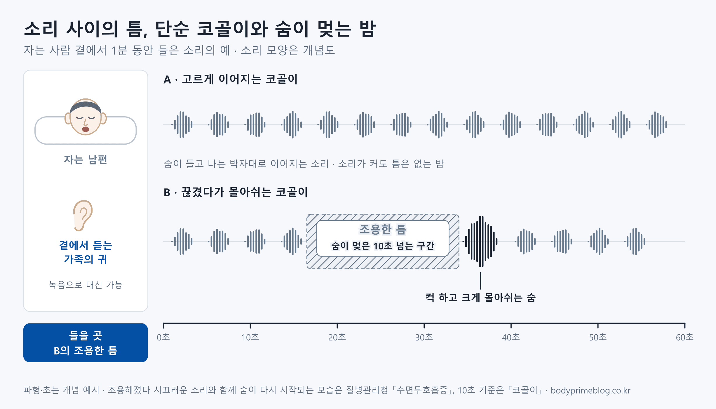 자는 남편 곁에서 1분 동안 들은 소리를 두 줄로 비교한 개념도입니다. 위 A 줄은 숨이 들고 나는 박자대로 고르게 이어지는 코골이로, 소리가 커도 틈이 없습니다. 아래 B 줄은 코골이가 이어지다 빗금으로 표시한 조용한 틈, 즉 숨이 멎은 10초 넘는 구간이 오고, 이어서 컥 하고 크게 몰아쉬는 큰 소리 뒤에 다시 코골이가 이어집니다. 왼쪽에는 곁에서 듣는 가족의 귀가 있고 녹음으로 대신할 수 있다고 적혀 있으며, 들을 곳은 B의 조용한 틈이라고 강조합니다. 파형과 초는 개념 예시입니다.